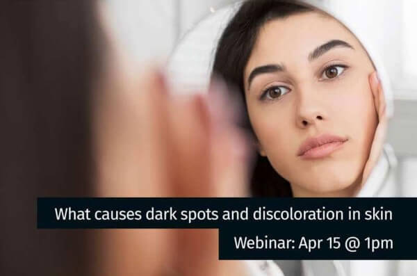 what causes dark spots and discoloration in skin