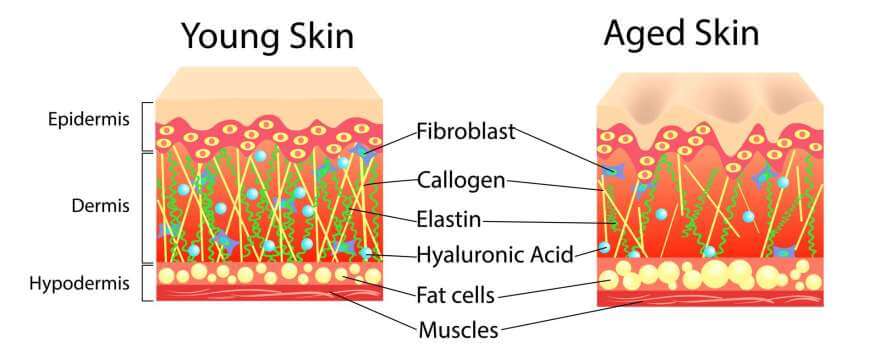 Young vs Old Skin diagram graphic