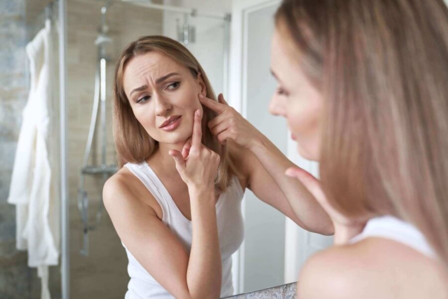 young-caucasian-woman-in-the-bathroom-having-acne