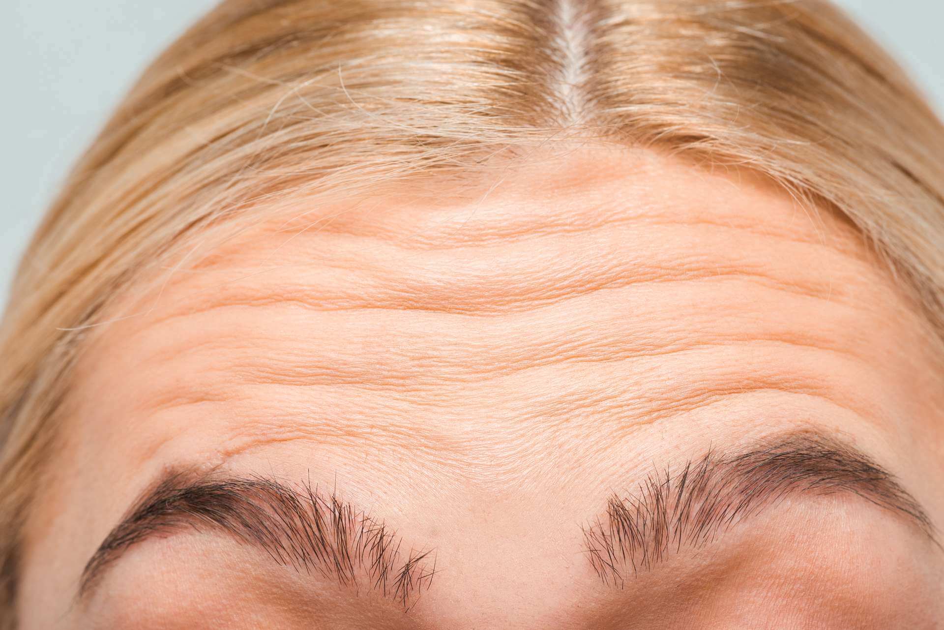 close up of forehead with wrinkles of woman 2022 12 16 16 12 30 utc