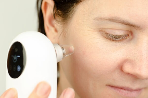 close up of using a facial blackhead removal machine. cosmetic procedure at home, woman cleaning face with vacuum blackhead remover.