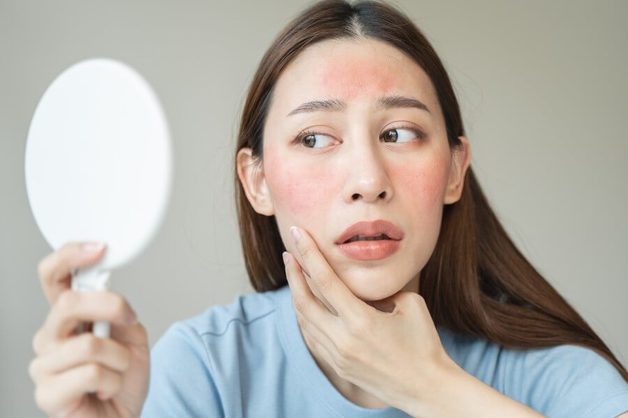 sensitive skin with cosmetology, asian young woman looking at red spot on her face from cosmetic allergy in the mirror.