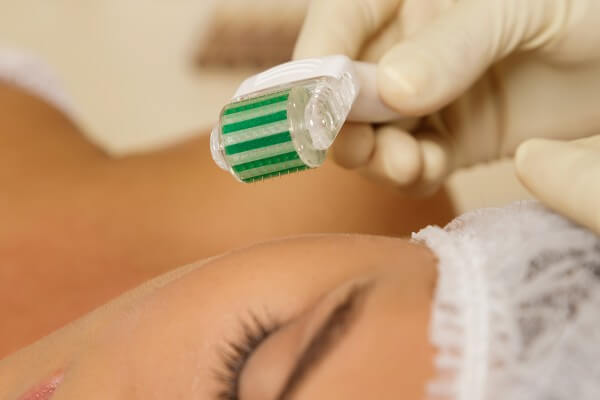 woman in beauty salon during mesotherapy procedure.