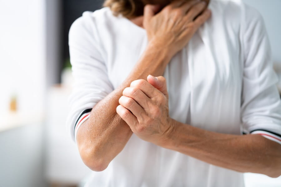 woman scratching itching body skin