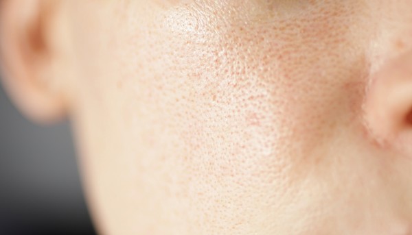 skin texture unhealthy with with enlarged pores a 2023 11 27 04 49 42 utc