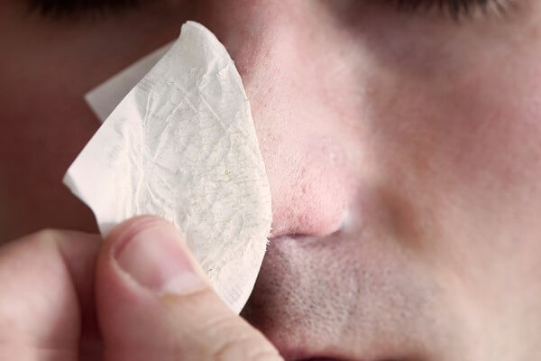 a man puts on and removes a strip for the nose from black dots. coal cleaning strips from blackheads and comedones. the concept of personal care.