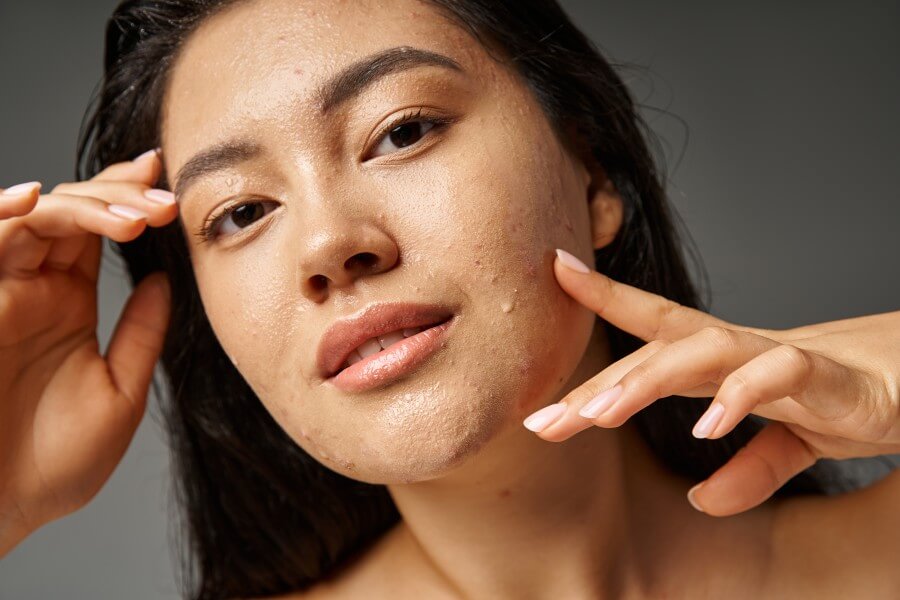 portrait of young asian woman with brunette hair and acne on wet face posing on grey background