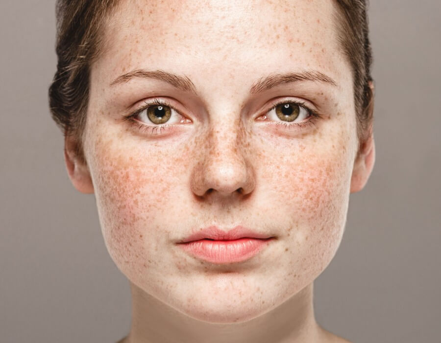 young beautiful freckles woman face portrait with healthy skin