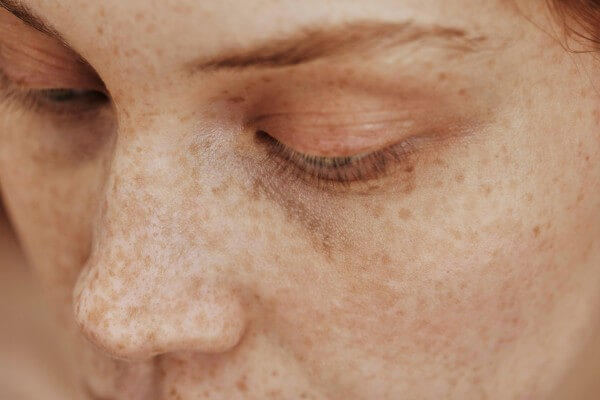 close up of female face with freckles