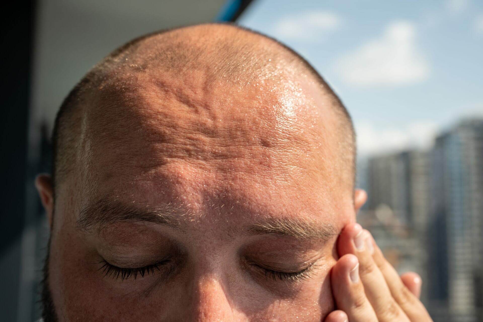 haggard overheated man with sweating forehead from heat of sun feeling head hurt, dizziness, nausea