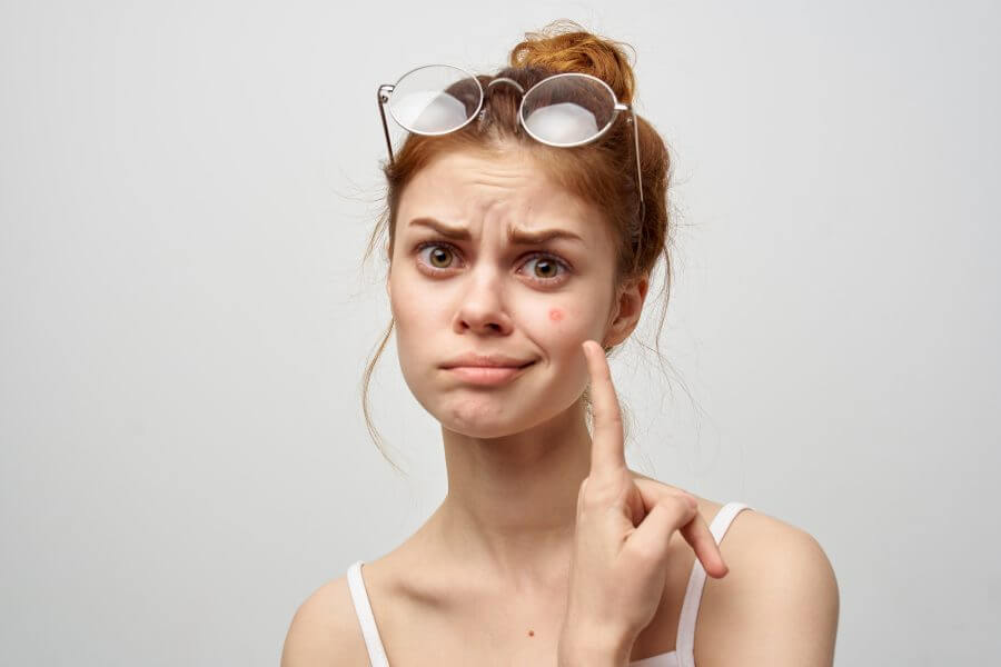 woman with a pimple on the face hygiene treatment