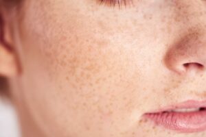 close up of woman s face with freckles 2024 11 27 15 55 34 utc